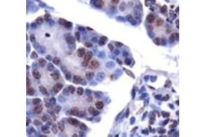 Staining of LPIN1 on mouse pancreas using LPIN1 polyclonal antibody . (Lipin 1 抗体  (AA 300-400))