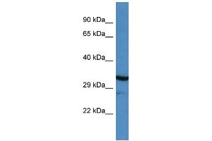 Western Blotting (WB) image for anti-Myocilin (MYOC) (N-Term) antibody (ABIN2774268) (MYOC 抗体  (N-Term))