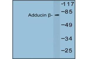 Western blot analysis of Beta-Adducin Antibody in extracts from 293 cells. (ADD2 抗体)