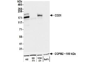 Western Blotting (WB) image for anti-Complement Component (3d/Epstein Barr Virus) Receptor 2 (CR2) (C-Term) antibody (ABIN7795815)
