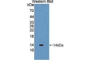 Detection of Recombinant PLOD2, Human using Polyclonal Antibody to Procollagen Lysine-2-Oxoglutarate-5-Dioxygenase 2 (PLOD2) (PLOD2 抗体  (AA 644-737))
