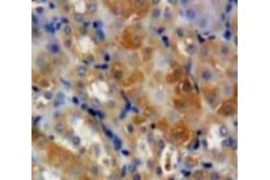 Used in DAB staining on fromalin fixed paraffin-embedded Kidney tissue (GAS2 抗体  (AA 64-267))