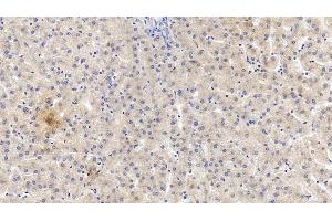 Detection of VF in Human Liver Tissue using Monoclonal Antibody to Visfatin (VF) (NAMPT 抗体  (AA 1-491))