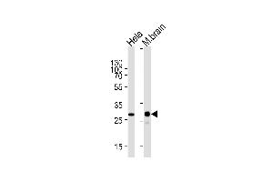 Western blot analysis of lysates from Hela cell line and mouse brain tissue lysate (from left to right) using CDK5 Antibody (ABIN1944859 and ABIN2843645). (CDK5 抗体  (AA 160-286))