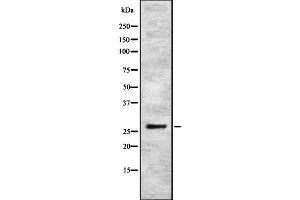 Western blot analysis IBP4 using K562 whole cell lysates (IGFBP4 抗体  (Internal Region))
