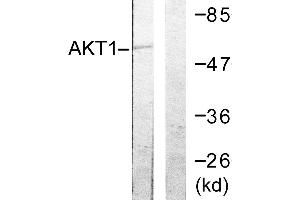 Immunohistochemistry analysis of paraffin-embedded human ovary tissue using Akt (Ab-72) antibody. (AKT1 抗体  (Thr72))