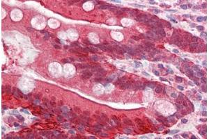 Human Small Intestine (formalin-fixed, paraffin-embedded) stained with FABP2 antibody ABIN337124 at 2. (FABP2 抗体  (AA 121-132))