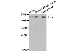Western blot analysis of extracts of various cell lines, using LUM antibody. (LUM 抗体  (AA 19-338))