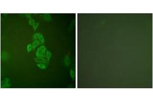 Immunofluorescence analysis of A549 cells, using NSE Antibody. (ENO2/NSE 抗体  (AA 371-420))