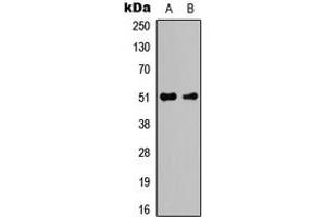 Western blot analysis of Caspase 2 expression in K562 (A), NIH3T3 (B) whole cell lysates. (Caspase 2 抗体  (Center))