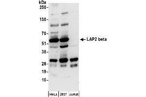 Western Blotting (WB) image for anti-LAP2 beta/tmpo (AA 225-275) antibody (ABIN7455055) (LAP2 beta/tmpo (AA 225-275) 抗体)
