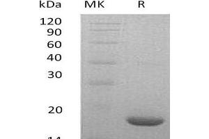 Western Blotting (WB) image for Leukemia Inhibitory Factor (LIF) protein (ABIN7320606) (LIF 蛋白)