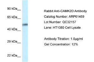 Western Blotting (WB) image for anti-Calcium/calmodulin-Dependent Protein Kinase II delta (CAMK2D) (C-Term) antibody (ABIN2788811) (CAMK2D 抗体  (C-Term))