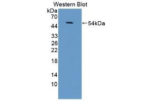 Detection of Recombinant LFA3, Human using Polyclonal Antibody to Cluster Of Differentiation 58 (CD58) (CD58 抗体  (AA 1-214))