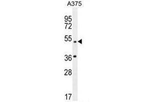 AP1M1 Antibody (Center) western blot analysis in A375 cell line lysates (35µg/lane). (AP1M1 抗体  (Middle Region))