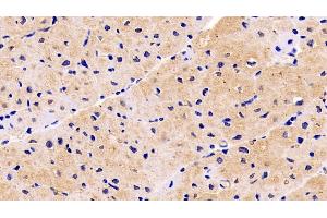 Detection of NRP1 in Human Cardiac Muscle Tissue using Monoclonal Antibody to Neuropilin 1 (NRP1) (Neuropilin 1 抗体  (AA 646-814))