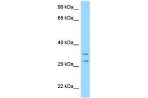Image no. 1 for anti-Ribosomal Protein S2 (RPS2) (AA 99-148) antibody (ABIN6748128) (RPS2 抗体  (AA 99-148))