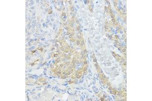 Immunohistochemistry (IHC) image for anti-Nucleotide-Binding Oligomerization Domain Containing 1 (NOD1) (AA 1-270) antibody (ABIN3021838)