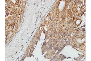 Image no. 1 for anti-Alveolar Soft Part Sarcoma Chromosome Region, Candidate 1 (ASPSCR1) (AA 1-554) antibody (ABIN466238) (ASPSCR1 抗体  (AA 1-554))