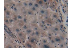 Immunohistochemistry (IHC) image for anti-Peroxisome Proliferator-Activated Receptor alpha (PPARA) (AA 61-170) antibody (ABIN7432904)