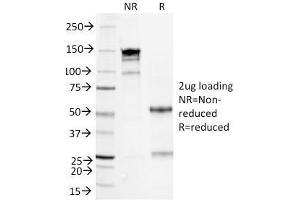 SDS-PAGE Analysis Purified Serum Amyloid A Mouse Monoclonal Antibody (SAA/326). (SAA 抗体)