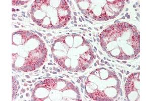 Immunohistochemistry (Paraffin-embedded Sections) (IHC (p)) image for anti-serine Peptidase Inhibitor, Kunitz Type 1 (SPINT1) (AA 168-217) antibody (ABIN6756664)