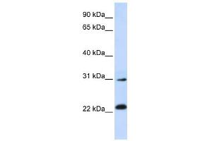 AP3S1 antibody used at 1 ug/ml to detect target protein. (AP3S1 抗体  (N-Term))