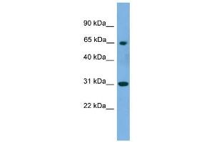 PNKP antibody used at 1 ug/ml to detect target protein. (PNKP 抗体  (Middle Region))