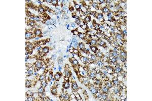Immunohistochemistry of paraffin-embedded rat liver using HSP Rabbit mAb (ABIN7267580) at dilution of 1:100 (40x lens). (HSPA4 抗体)