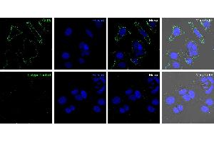 anti-Solute Carrier Family 39 (Zinc Transporter), Member 6 (SLC39A6) (AA 251-264), (Extracellular), (N-Term) antibody