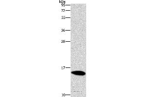 Western blot analysis of Mouse brain tissue, using CST4 Polyclonal Antibody at dilution of 1:1450 (CST4 抗体)