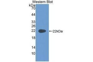 Detection of Recombinant KRT4, Rat using Monoclonal Antibody to Cytokeratin 4 (CK4) (KRT4 抗体  (AA 317-454))