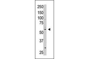 The CREB3L1 polyclonal antibody  is used in Western blot to detect CREB3L1 in A-375 cell lysate. (CREB3L1 抗体  (C-Term))