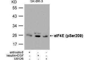 Western blot analysis of extracts from SK-BR-3 cells, untreated or insulin and EGF treated, and pretreated with U0126 cells, using eIF4E (Phospho-Ser209) Antibody. (EIF4E 抗体  (pSer209))