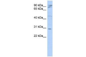 HAX1 antibody used at 1 ug/ml to detect target protein. (HAX1 抗体  (Middle Region))