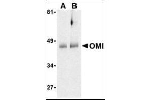Western blot analysis of OMI in human colon cell lysates with this product at (A) 0. (HTRA2 抗体  (C-Term))
