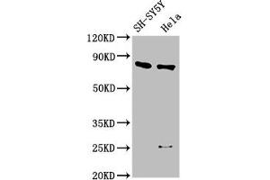 Western Blot Positive WB detected in: SH-SY5Y whole cell lysate, Hela whole cell lysate All lanes: CTNNB1 antibody at 2. (CTNNB1 抗体  (AA 2-781))