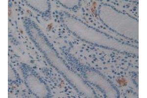 Detection of CD56 in Human Stomach Tissue using Polyclonal Antibody to Cluster Of Differentiation 56 (CD56) (CD56 抗体  (AA 340-608))