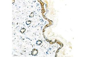 Immunohistochemistry (Paraffin-embedded Sections) (IHC (p)) image for anti-High Mobility Group Nucleosome Binding Domain 1 (HMGN1) antibody (ABIN7074222)