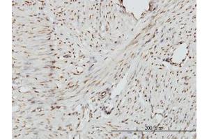 Image no. 1 for anti-Zinc Fingers and Homeoboxes 2 (ZHX2) (AA 691-789) antibody (ABIN599184) (ZHX2 抗体  (AA 691-789))