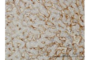 Image no. 1 for anti-EH-Domain Containing 3 (EHD3) (AA 357-407) antibody (ABIN599233) (EHD3 抗体  (AA 357-407))