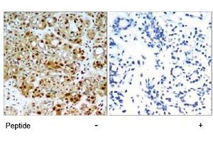 Image no. 1 for anti-Heat Shock Protein 90kDa alpha (Cytosolic), Class B Member 1 (HSP90AB1) (Ser254) antibody (ABIN197568)