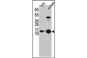 Western blot analysis of LC3B Antibody (LC3B 抗体  (N-Term))