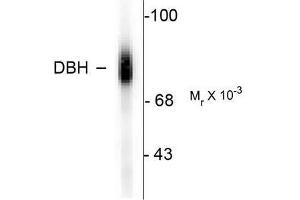 Image no. 1 for anti-Dopamine beta-Hydroxylase (Dopamine beta-Monooxygenase) (DBH) (C-Term) antibody (ABIN372611) (DBH 抗体  (C-Term))