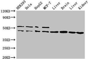 Western Blot Positive WB detected in: HEK293 whole cell lysate, Hela whole cell lysate, HepG2 whole cell lysate, MCF-7 whole cell lysate, Rat liver tissue, Mouse brain tissue, Mouse liver tissue, Mouse kidney tissue All lanes: IDH1 antibody at 2 μg/mL Secondary Goat polyclonal to rabbit IgG at 1/50000 dilution Predicted band size: 47 kDa Observed band size: 47, 52 kDa (IDH1 抗体  (AA 1-240))