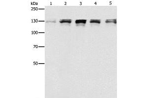 Western Blot analysis of Human fetal small intestine, liver cancer and Lymphoma Lymphoma, 293T and A549 cell using DDB1 Polyclonal Antibody at dilution of 1:500 (DDB1 抗体)