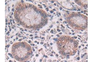 DAB staining on IHC-P; Samples: Human Stomach Tissue (CBL 抗体  (AA 558-816))