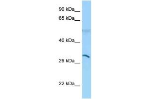 WB Suggested Anti-CD1B Antibody Titration: 1. (CD1b 抗体  (N-Term))