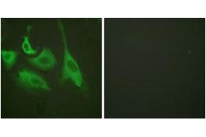 Immunofluorescence analysis of HeLa cells treated with TNF-a 20nM 15', using HSP90B (Phospho-Ser254) Antibody. (HSP90AB1 抗体  (pSer254))