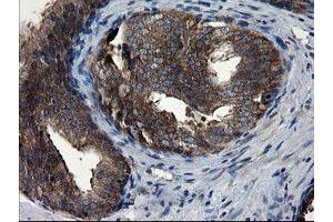 Image no. 7 for anti-CCR4-NOT Transcription Complex Subunit 4 (CNOT4) (AA 190-455) antibody (ABIN1491098)